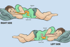 What Is the Best Sleeping Position for Digestion? – Expert Info (Spring ...