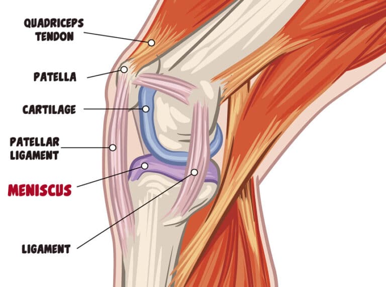 how-to-sleep-after-meniscus-surgery-everything-you-need-to-know